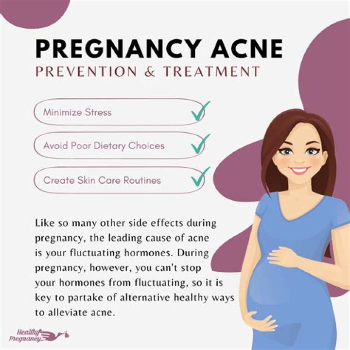 Does pregnancy acne mean a girl?