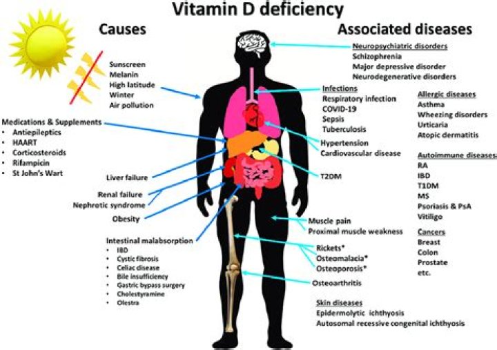What happens if vitamin D deficiency is not treated?