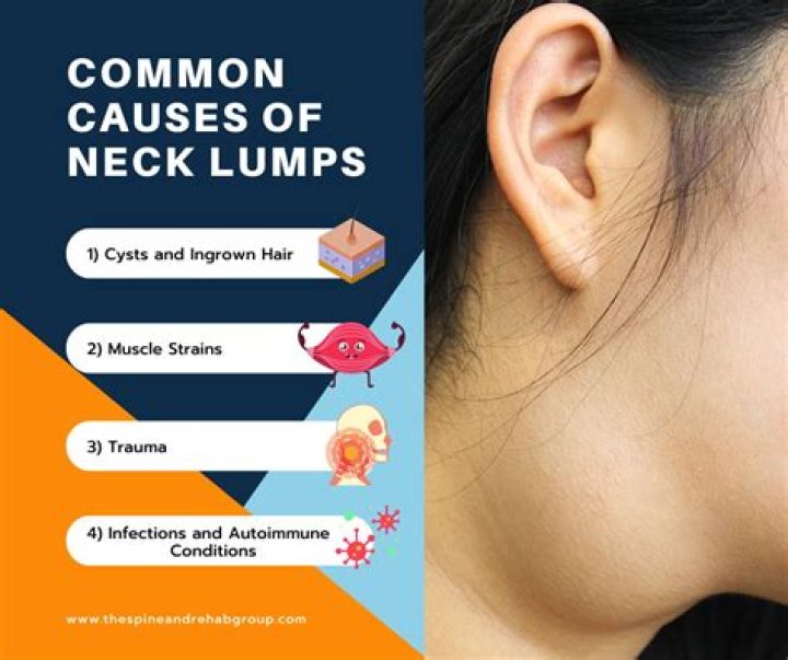 What is the pea sized lump in my cheek?