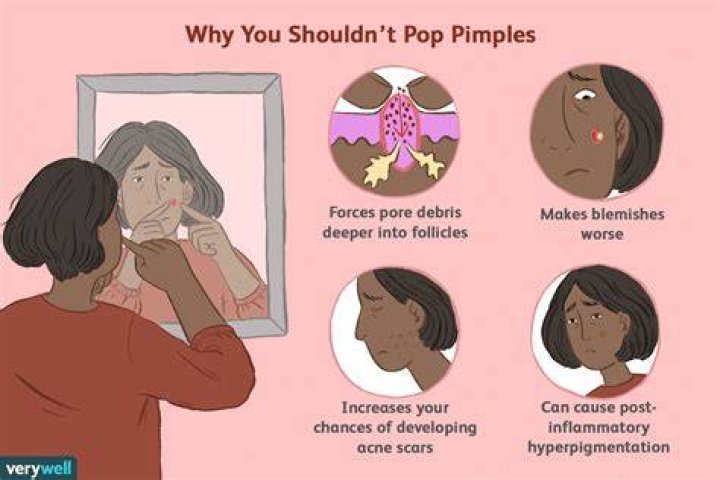 Why do pimples bleed after you pop them?