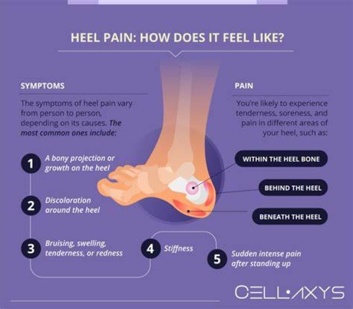 Why is my heel purple?
